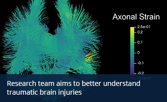 3D image of brain injury damage